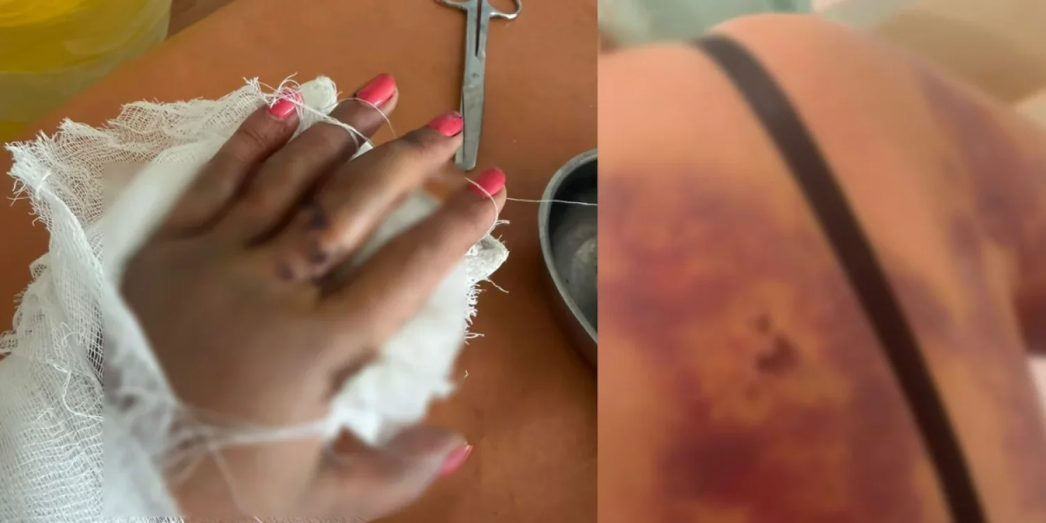 Жетісу облысында әйелді көршісі күрекпен ұрған (ВИДЕО)