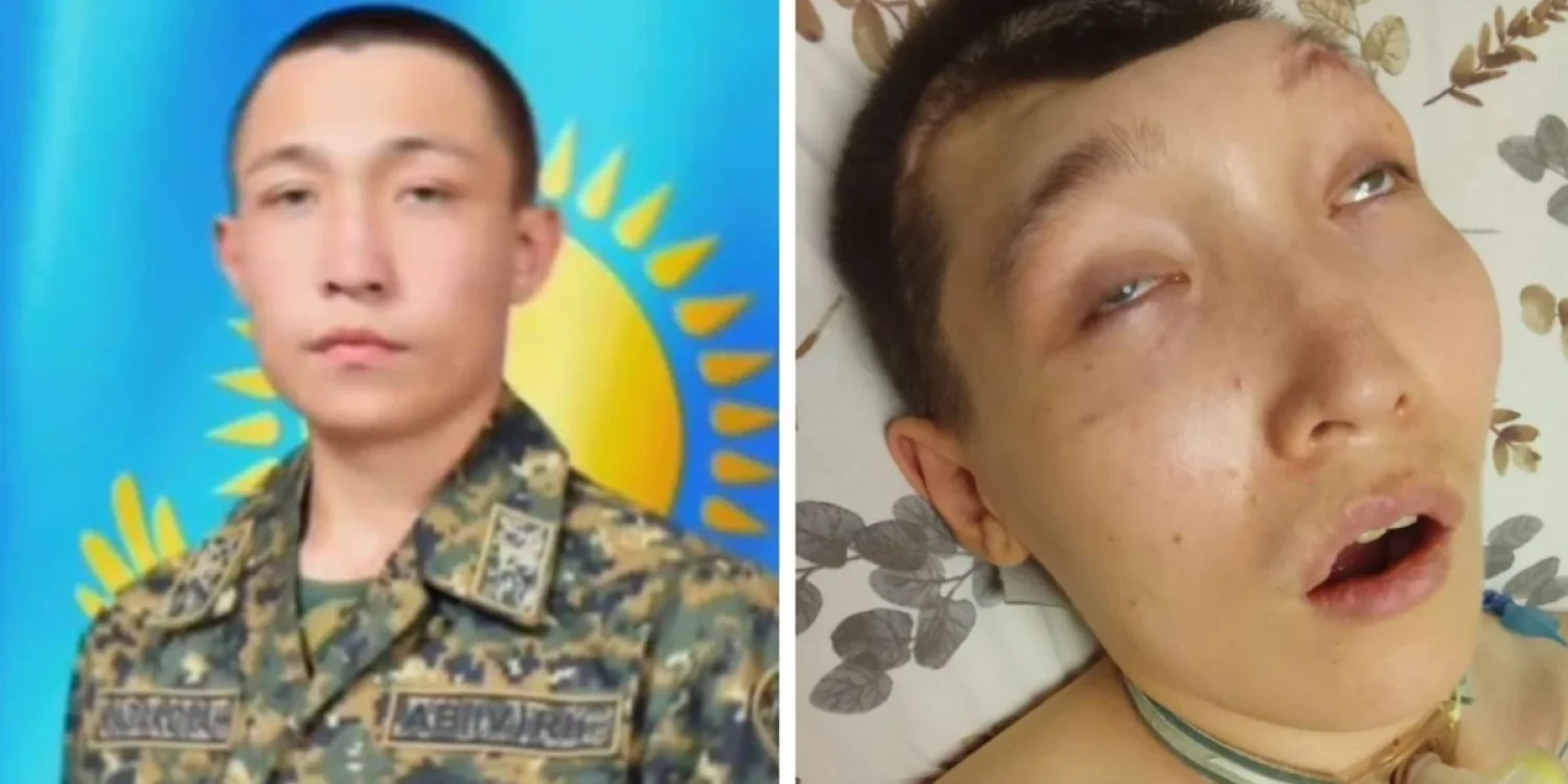 «Әскерден мүгедек болып оралды»: Төсекке таңылған сарбаздың ата-анасы ресми диагнозға сенбейді